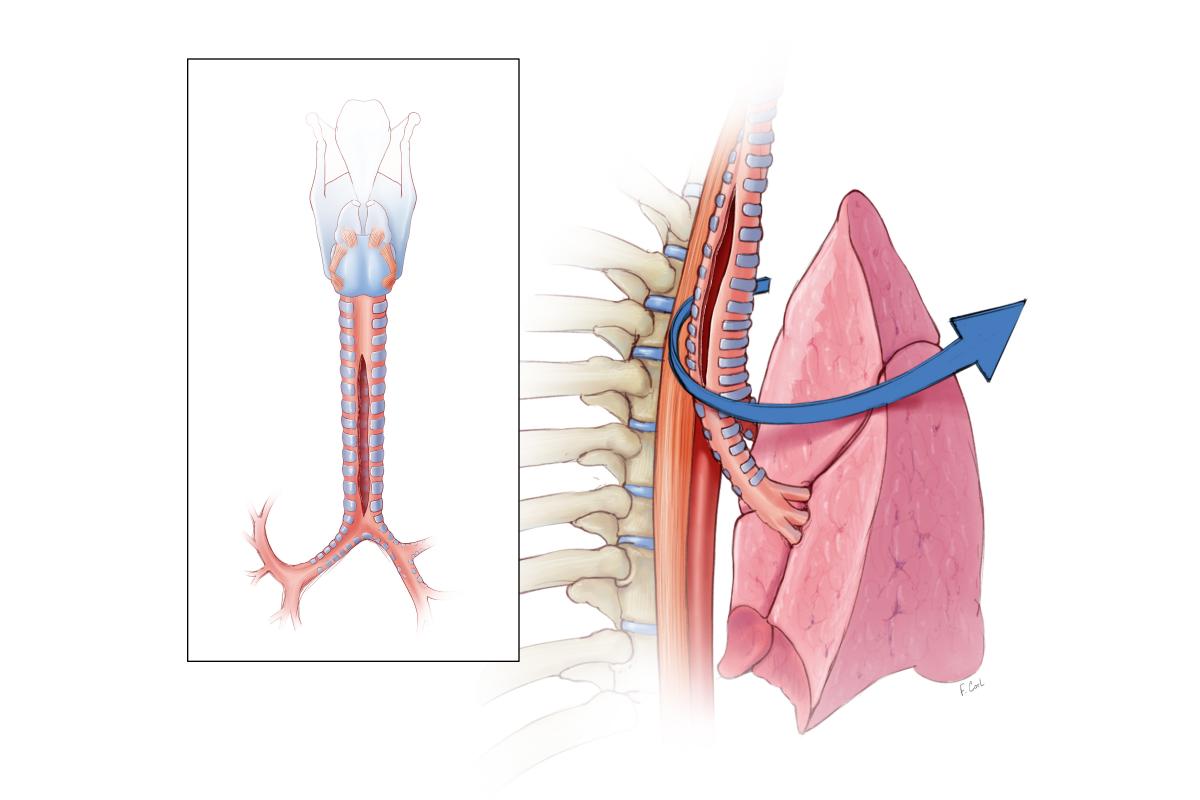 Multidisciplinary Management and Repair of a Traumatic Posterior